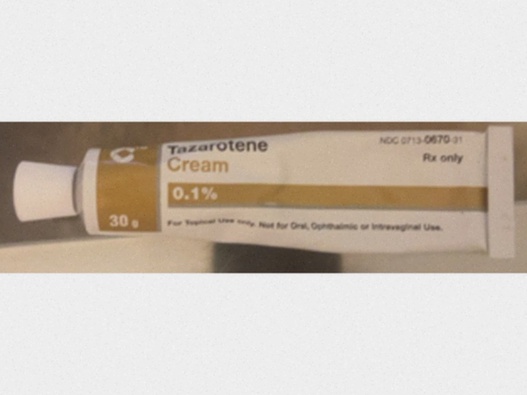 Tazarotene Rezeptfrei online Generika